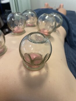 鍼灸院接骨院テトテ(tetote)/施術風景