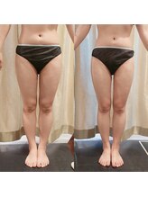 マイフェアレディ 今池(MyFairLady)/【名古屋希少】ラフォス高周波