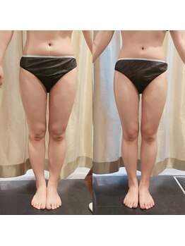 マイフェアレディ 今池(MyFairLady)/【名古屋希少】ラフォス高周波