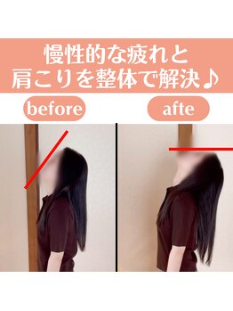 整体天使のはね 福山店/慢性的な疲れと肩こりを解決!