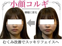 ロージースマイル(Rosy smile)