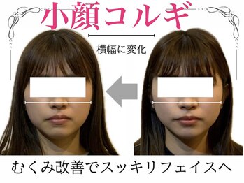 ロージースマイル(Rosy smile)