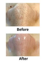 サロンリアンジュ ひたちなか店(Salon Liange)/◇毛穴洗浄◇ハイドロスキン◇