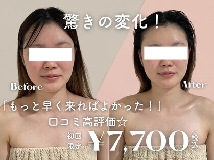 イデアルミー 大宮店(イデアルMe)の写真