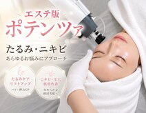 アンノン(Annon)