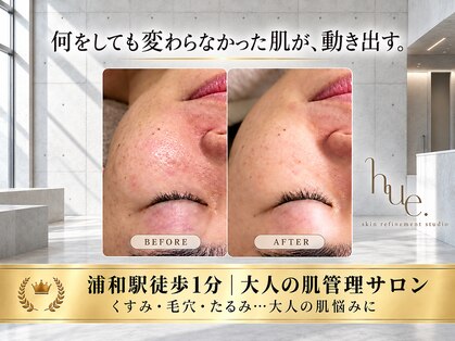 ヒュウ(hue.)の写真