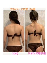 リオンズ 茨城ミスターマックス取手店/セルバーン付き　24回　20代女性