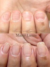 マリーロール 梅田店(Marie Laure)/深爪矯正/自爪育成/自爪風