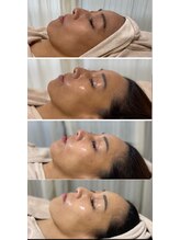 エムイーボーテ(me.Beaute)/【セルマン】努力の賜物☆