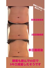 サロン ド エムジョリー(Salon de M Jolie)/痩身＋脂肪分解液で効果爆上げ！