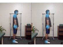 整骨院こころ 曙院/ビフォーアフター