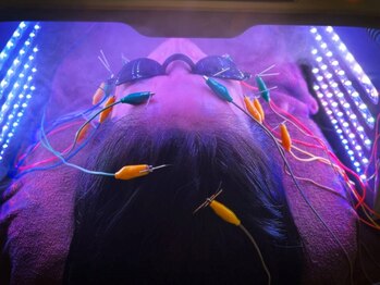 ハリロイヤル トーキョー武蔵小山の写真/人体の構造学に基づく美容鍼。本気で変わりたいなら、顔の深部から動かしに来たら?