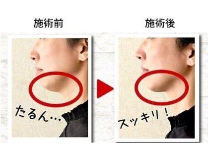 イービーシーシー 名古屋駅前(e.b.c.c.)の写真