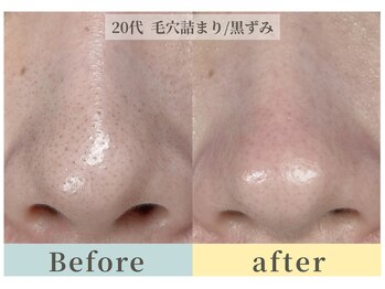 ムク(Muqu.)/初めての毛穴エクストラクション