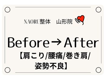 ナオル整体 山形院(NAORU整体)/Before→After