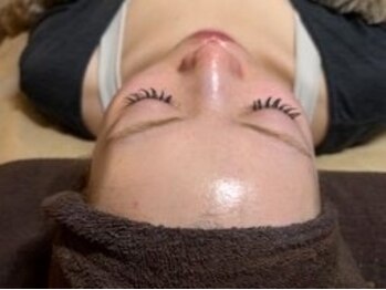 セルヴィノバ(CELL VI NOVA)の写真/【ニキビ・肌荒れ改善に◎】剥離なしの次世代ピーリングで肌質を根本からケア!感動の美肌体験を☆
