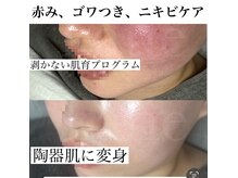 ケイティ(Katie)