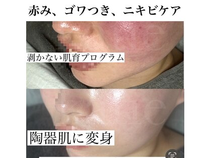 ケイティ(Katie)の写真