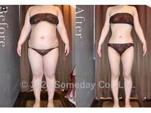 サムデイプレミアム 白金店(SOMEDAY PREMIUM)/Before⇒Afterの変化