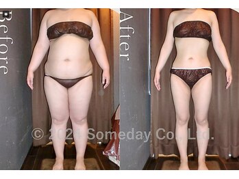 サムデイプレミアム 白金店(SOMEDAY PREMIUM)/Before⇒Afterの変化