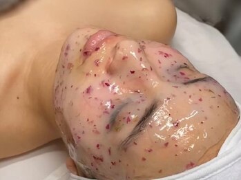 ザ ラウラ ビューティー フェイシャル(THE LAULA BEAUTY)の写真/【医療提携】話題の『韓美白ピーリング』で肌トラブルを徹底改善！肌質やお悩みに合わせてプロがサポート！
