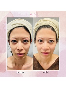 プリエ/フェイシャルエステ
