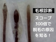 アロマベアー(Aroma Bear)/「MOUMITUエステ」毛根診断