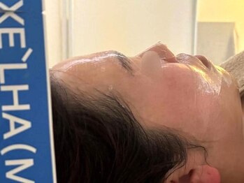 イイプラス(ii+)の写真/年齢や季節の変わり目による肌悩みにアプローチ!ダウンタイムなしのセラピールでシミ・しわ・たるみケアを!