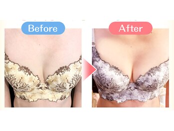 ヒーリング スポット/【Before＆After】