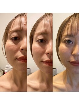 オーブ たかまつはり灸整骨院くじら館(aube)/