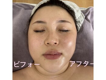 サロン ド アヤ(salon de Aya)/小顔術