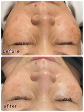 ケースタイル(k.style)/3回目