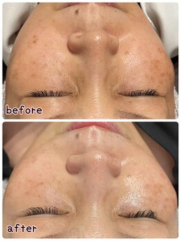 ケースタイル(k.style)/3回目