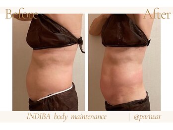 パリワール(pariwar)/インディバ*ビフォーアフター