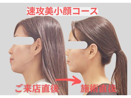 エンジェル(Angel)の写真