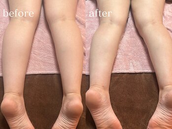 ハダケア(HADA CARE)/美白大作戦★ふわっと泡美白