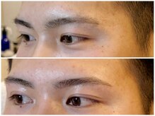 スリーピース(3Peace)/アーチ眉 Before/After