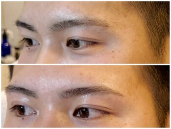 スリーピース(3Peace)/アーチ眉 Before/After