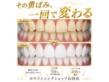 ホワイトニングショップ 山科店の雰囲気（矯正中も通って頂けます！ホワイトニングショップ山科店）