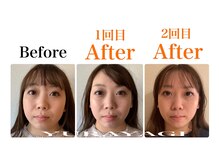 小顔屋ゆらやぎ/