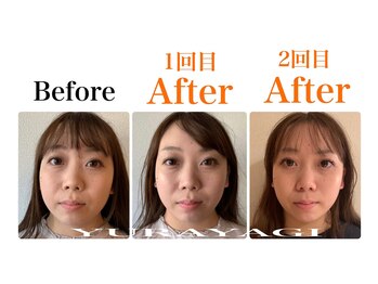 小顔屋ゆらやぎ/