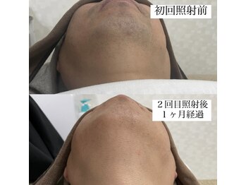 テンパ ビューティー(+10%beauty)/効果写真