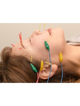 鍼灸施術を受けたい