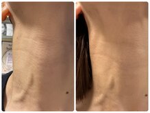 ベルドア(Bell Door)/首ケア