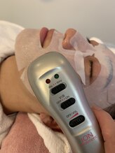 ステラ(Stella)/イオ導入＆水素ピーリング