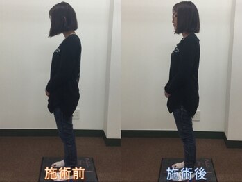 心笑整体院/施術