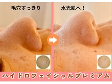 ミンクル(MINKL)