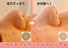 ミンクル(MINKL)