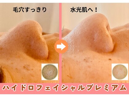 ミンクル(MINKL)の写真