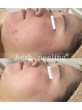 スリリアン 銀座/★お客さまビフォーアフター★